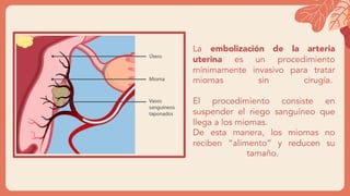 La embolización de la arteria
uterina es un procedimiento
mínimamente invasivo para tratar
miomas sin cirugía.
El procedimiento consiste en
suspender el riego sanguíneo que
llega a los miomas.
De esta manera, los miomas no
reciben “alimento” y reducen su
tamaño.
 