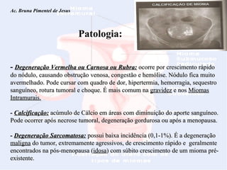 Ac. Bruna Pimentel de Jesus  Miomatose Uterina Patologia: -  Degeneração Vermelha ou Carnosa ou Rubra:  ocorre por crescimento rápido do nódulo, causando obstrução venosa, congestão e hemólise. Nódulo fica muito avermelhado. Pode cursar com quadro de dor, hipertermia, hemorragia, sequestro sanguíneo, rotura tumoral e choque. É mais comum na  gravidez  e nos  Miomas Intramurais. -  Calcificação:  acúmulo de Cálcio em áreas com diminuição do aporte sanguíneo. Pode ocorrer após necrose tumoral, degeneração gordurosa ou após a menopausa. -  Degeneração Sarcomatosa:  possui baixa incidência (0,1-1%). É a degeneração  maligna  do tumor, extremamente agressivos, de crescimento rápido e  geralmente encontrados na pós-menopausa ( idosa ) com súbito crescimento de um mioma pré-existente. 