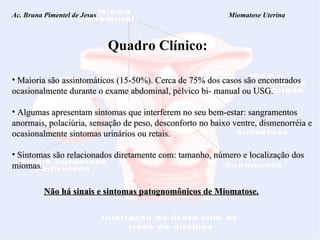 Ac. Bruna Pimentel de Jesus  Miomatose Uterina Quadro Clínico: Maioria são assintomáticos (15-50%). Cerca de 75% dos casos são encontrados ocasionalmente durante o exame abdominal, pélvico bi- manual ou USG. Algumas apresentam sintomas que interferem no seu bem-estar: sangramentos anormais, polaciúria, sensação de peso, desconforto no baixo ventre, dismenorréia e ocasionalmente sintomas urinários ou retais. Sintomas são relacionados diretamente com: tamanho, número e localização dos miomas. Não há sinais e sintomas patognomônicos de Miomatose. 