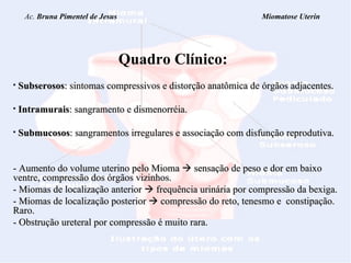 Ac.  Bruna Pimentel de Jesus  Miomatose Uterin Quadro Clínico: Subserosos : sintomas compressivos e distorção anatômica de órgãos adjacentes. Intramurais : sangramento e dismenorréia. Submucosos : sangramentos irregulares e associação com disfunção reprodutiva.  - Aumento  do volume uterino pelo Mioma    sensação de peso e dor em baixo ventre, compressão dos órgãos vizinhos. - Miomas de localização anterior    frequência urinária por compressão da bexiga. - Miomas de localização posterior    compressão do reto, tenesmo e  constipação. Raro. - Obstrução ureteral por compressão é muito rara. 