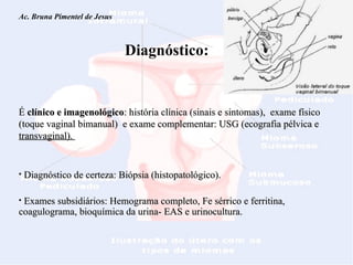 Ac. Bruna Pimentel de Jesus  Miomatose Uterina   Diagnóstico: É  clínico e imagenológico : história clínica (sinais e sintomas),  exame físico (toque vaginal bimanual)  e exame complementar: USG (ecografia pélvica e  transvaginal).  Diagnóstico de certeza: Biópsia (histopatológico).  Exames subsidiários: Hemograma completo, Fe sérrico e ferritina, coagulograma, bioquímica da urina- EAS e urinocultura. 