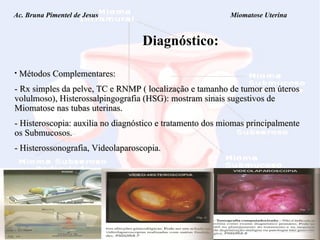 Ac. Bruna Pimentel de Jesus  Miomatose Uterina Diagnóstico: Métodos Complementares: - Rx simples da pelve, TC e RNMP ( localização e tamanho de tumor em úteros volulmoso), Histerossalpingografia (HSG): mostram sinais sugestivos de Miomatose nas tubas uterinas. - Histeroscopia: auxilia no diagnóstico e tratamento dos miomas principalmente os Submucosos.  - Histerossonografia, Videolaparoscopia. 