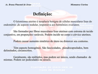 Ac. Bruna Pimentel de Jesus  Miomatose Uterina Definição: O leiomioma uterino é neoplasia benigna de células musculares lisas do  endométrio ,de aspecto nodular, responsiva aos hormônios ovarianos. São formados por fibras musculares lisas uterinas com estroma de tecido conjuntivo, em proporções variáveis. Podem incidir no corpo e cérvice uterinos. Podem causar  aumento simétrico do útero ou distorcer seu contorno. Têm aspecto homogêneo. São fasciculados,  pseudocapsulados, bem delimitados, circunscritos. Geralmente, são múltiplos, mas podem ser únicos, sendo chamados  de miomas. Podem ser pediculados ou sésseis. 