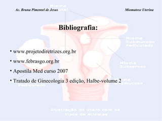 Ac. Bruna Pimentel de Jesus  Miomatose Uterina Bibliografia: www.projetodiretrizes.org.br www.febrasgo.org.br Apostila Med curso 2007 Tratado de Ginecologia 3 edição, Halbe-volume 2 