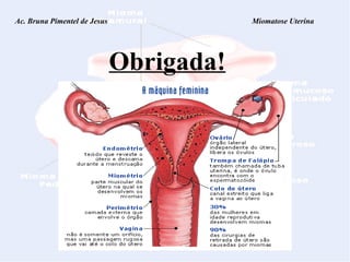 Ac. Bruna Pimentel de Jesus  Miomatose Uterina Obrigada! 