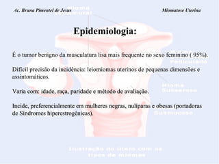 Ac. Bruna Pimentel de Jesus  Miomatose Uterina Epidemiologia: É o tumor benigno da musculatura lisa mais frequente no sexo feminino ( 95%). Difícil precisão da incidência: leiomiomas uterinos de pequenas dimensões e  assintomáticos. Varia com: idade, raça, paridade e método de avaliação.  Incide, preferencialmente em mulheres negras, nulíparas e obesas (portadoras  de Síndromes hiperestrogênicas). 