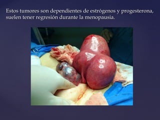 Estos tumores son dependientes de estrógenos y progesterona,Estos tumores son dependientes de estrógenos y progesterona,
s...
