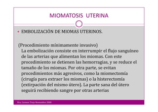Miomatosis Uterina