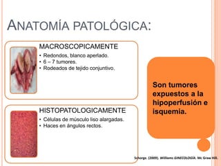 ANATOMÍA PATOLÓGICA:
MACROSCOPICAMENTE
• Redondos, blanco aperlado.
• 6 – 7 tumores.
• Rodeados de tejido conjuntivo.
HISTOPATOLOGICAMENTE
• Células de músculo liso alargadas.
• Haces en ángulos rectos.
Son tumores
expuestos a la
hipoperfusión e
isquemia.
Schorge. (2009). Williams GINECOLOGÍA. Mc Graw Hill.
 