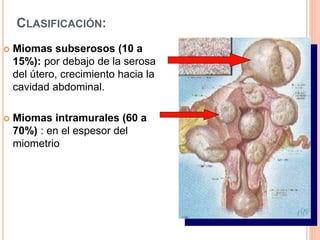 CLASIFICACIÓN:
 Miomas subserosos (10 a
15%): por debajo de la serosa
del útero, crecimiento hacia la
cavidad abdominal.
 Miomas intramurales (60 a
70%) : en el espesor del
miometrio
 
