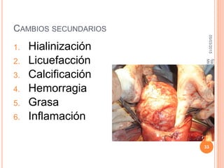 CAMBIOS SECUNDARIOS
1. Hialinización
2. Licuefacción
3. Calcificación
4. Hemorragia
5. Grasa
6. Inflamación
05/03/2015
33
fjgg
MIOMATOSISUTERINA
 