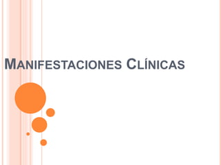 MANIFESTACIONES CLÍNICAS
 