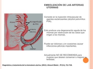 EMBOLIZACIÓN DE LAS ARTERIAS
UTERINAS
Consiste en la inyección intravascular de
agentes esclerosantes (alcohol polivinílico
PVA).
Esto produce una degeneración aguda de los
miomas por obstrucción de los vasos que
irrigan a los miomas.
Puede ser doloroso y en ocasiones causar
infecciones pélvicas importantes.
Actualmente NO SE RECOMIENDA para
mujeres que deseen conservar o mejorar su
fertilidad.
Diagnóstico y tratamiento de la miomatosis uterina. (2011). Ginecol Obstet , 79 (11), 711-718.
 