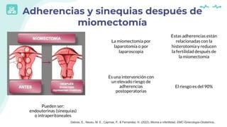 Adherencias y sinequias después de
miomectomía
La miomectomía por
laparotomía o por
laparoscopia
Es una intervención con
u...