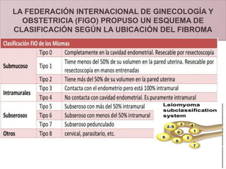 Myome Classification Comprehensive Overview of Uterine Fibroids (Miomatosis Uterina ...