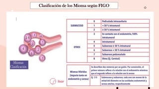 MIOMA UTERINO pptx mioma-uterino-pptx