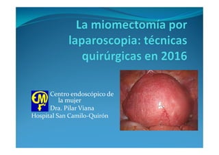 Centro endoscópico de
la mujer
Dra. Pilar Viana
Hospital San Camilo-Quirón
 