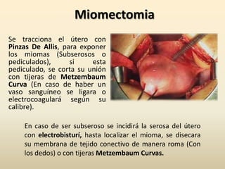 MiomectomiaSe tracciona el útero con Pinzas De Allis, para exponer los miomas (Subserosos o pediculados), si esta pediculado, se corta su unión con tijeras de Metzembaum Curva (En caso de haber un vaso sanguíneo se ligara o electrocoagulará según su calibre).En caso de ser subseroso se incidirá la serosa del útero con electrobisturí, hasta localizar el mioma, se disecara su membrana de tejido conectivo de manera roma (Con los dedos) o con tijeras Metzembaum Curvas.