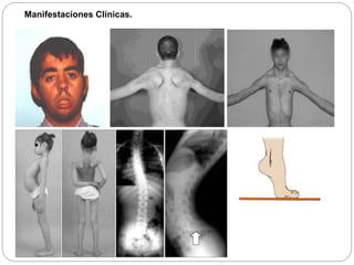 Manifestaciones Clínicas.
 