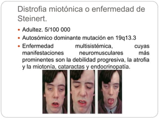 Distrofia miotónica o enfermedad de
Steinert.
 Adultez. 5/100 000
 Autosómico dominante mutación en 19q13.3
 Enfermedad multisistémica, cuyas
manifestaciones neuromusculares más
prominentes son la debilidad progresiva, la atrofia
y la miotonía, cataractas y endocrinopatía.
 