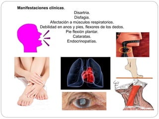 Manifestaciones clínicas.
Disartria.
Disfagia.
Afectación a músculos respiratorios.
Debilidad en anos y pies, flexores de los dedos.
Pie flexión plantar.
Cataratas.
Endocrinopatías.
 