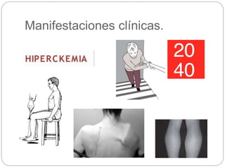 Manifestaciones clínicas.
 