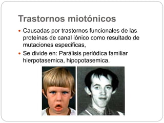 Trastornos miotónicos
 Causadas por trastornos funcionales de las
proteínas de canal iónico como resultado de
mutaciones especificas,
 Se divide en: Parálisis periódica familiar
hierpotasemica, hipopotasemica.
 