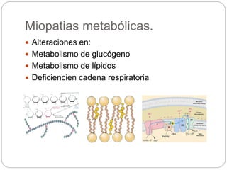 Miopatias metabólicas.
 Alteraciones en:
 Metabolismo de glucógeno
 Metabolismo de lípidos
 Deficiencien cadena respiratoria
 