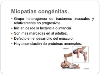 Miopatías congénitas.
 Grupo heterogéneo de trastornos inusuales y
relativamente no progresivos.
 Inician desde la lactancia o infancia
 Son mas marcadas en al adultez.
 Defecto en el desarrollo del músculo.
 Hay acumulación de proteínas anormales.
 