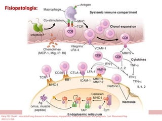 Fisiopatología:
Kiely PD, Chua F. Interstitial lung disease in inflammatory myopathies: clinical phenotypes and prognosis. Curr Rheumatol Rep
2013;15:359.
 
