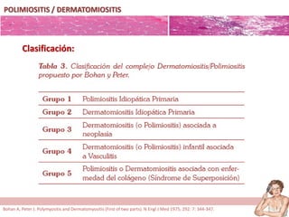 POLIMIOSITIS / DERMATOMIOSITIS
Clasificación:
Bohan A, Peter J. Polymyositis and Dermatomyositis (First of two parts). N Engl J Med 1975; 292: 7: 344-347.
 