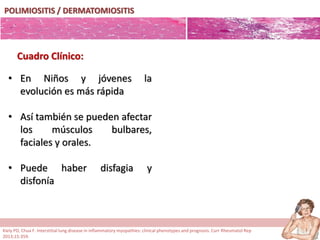 POLIMIOSITIS / DERMATOMIOSITIS
• En Niños y jóvenes la
evolución es más rápida
• Así también se pueden afectar
los músculos bulbares,
faciales y orales.
• Puede haber disfagia y
disfonía
Cuadro Clínico:
Kiely PD, Chua F. Interstitial lung disease in inflammatory myopathies: clinical phenotypes and prognosis. Curr Rheumatol Rep
2013;15:359.
 