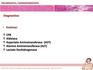 POLIMIOSITIS / DERMATOMIOSITIS
• Enzimas:
↑ CPK
↑ Aldolasa
↑ Aspartato Aminotransferasa (AST)
↑ Alanino Aminotransferasa (ALT)
↑ Lactato Deshidrogenasa
Diagnostico:
Dalakas MC. Review: an update on inflammatory and autoimmune myopathies. 2011; 37:226-42
 