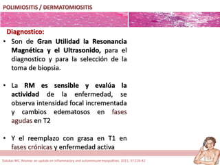 POLIMIOSITIS / DERMATOMIOSITIS
Diagnostico:
• Son de Gran Utilidad la Resonancia
Magnética y el Ultrasonido, para el
diagnostico y para la selección de la
toma de biopsia.
• La RM es sensible y evalúa la
actividad de la enfermedad, se
observa intensidad focal incrementada
y cambios edematosos en fases
agudas en T2
• Y el reemplazo con grasa en T1 en
fases crónicas y enfermedad activa
Dalakas MC. Review: an update on inflammatory and autoimmune myopathies. 2011; 37:226-42
 