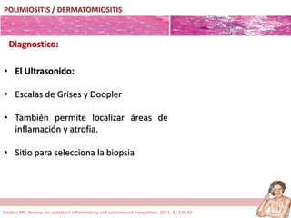 POLIMIOSITIS / DERMATOMIOSITIS
Diagnostico:
• El Ultrasonido:
• Escalas de Grises y Doopler
• También permite localizar áreas de
inflamación y atrofia.
• Sitio para selecciona la biopsia
Dalakas MC. Review: an update on inflammatory and autoimmune myopathies. 2011; 37:226-42
 