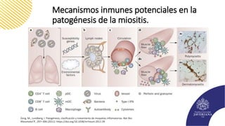 Mecanismos inmunes potenciales en la
patogénesis de la miositis.
Zong, M., Lundberg, I. Patogénesis, clasificación y tratamiento de miopatías inflamatorias. Nat Rev
Rheumatol 7 , 297–306 (2011). https://doi.org/10.1038/nrrheum.2011.39
 