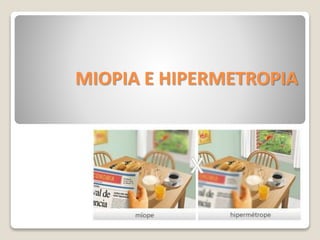 MIOPIA E HIPERMETROPIA
 