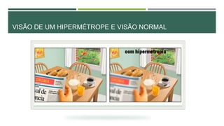 VISÃO DE UM HIPERMÉTROPE E VISÃO NORMAL
 