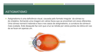 ASTIGMATISMO
 Astigmatismo é uma deficiência visual, causada pelo formato irregular da córnea ou
do cristalino, formando uma imagem em vários focos que se encontram em eixos diferentes.
Uma córnea normal é redonda e lisa e nos casos de astigmatismo, a curvatura da córnea é
mais ovalada. Este desajuste faz com que a luz se retrate por vários pontos da retina em vez
de se focar em apenas um.
 