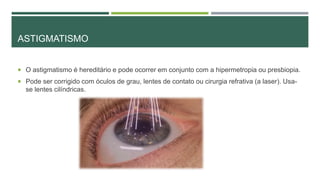 ASTIGMATISMO
 O astigmatismo é hereditário e pode ocorrer em conjunto com a hipermetropia ou presbiopia.
 Pode ser corrigido com óculos de grau, lentes de contato ou cirurgia refrativa (a laser). Usa-
se lentes cilíndricas.
 