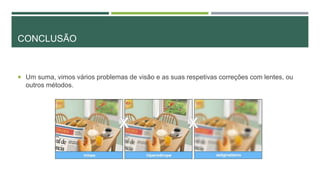 CONCLUSÃO
 Um suma, vimos vários problemas de visão e as suas respetivas correções com lentes, ou
outros métodos.
 