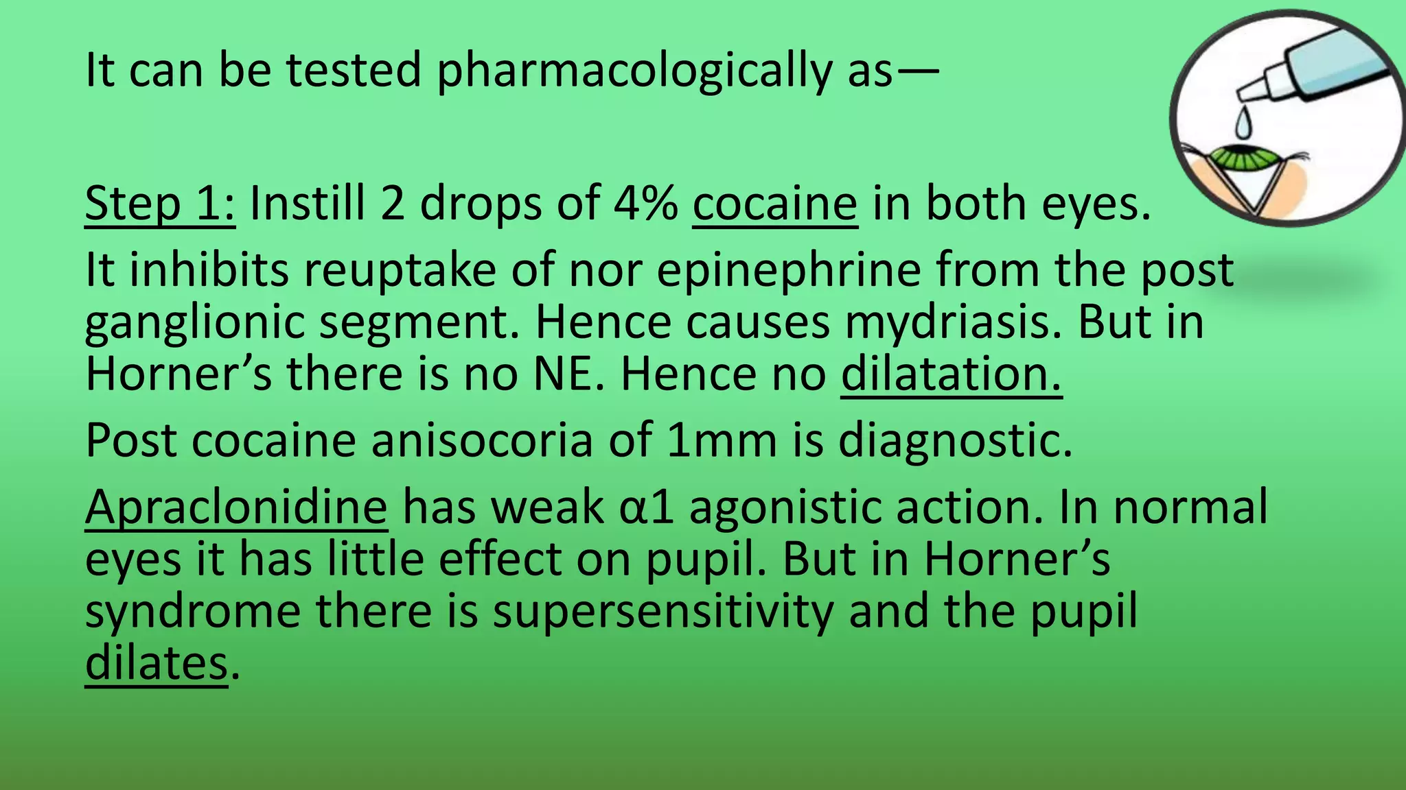 It can be tested pharmacologically as—
Step 1: Instill 2 drops of 4% cocaine in both eyes.
It inhibits reuptake of nor epinephrine from the post
ganglionic segment. Hence causes mydriasis. But in
Horner’s there is no NE. Hence no dilatation.
Post cocaine anisocoria of 1mm is diagnostic.
Apraclonidine has weak α1 agonistic action. In normal
eyes it has little effect on pupil. But in Horner’s
syndrome there is supersensitivity and the pupil
dilates.
 