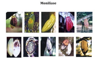 Monilíase
 