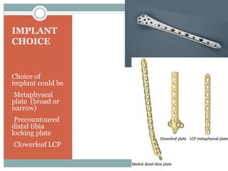 IMPLANT
CHOICE
Choice of
implant could be
•Metaphyseal
plate (broad or
narrow)
•Precountoured
distal tibia
locking plate
•Clowerleaf LCP
 