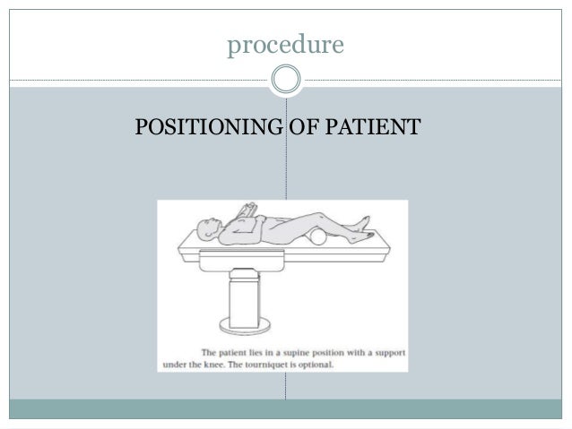 percutaneous plate osteosynthesis Minimally invasive technique for stabilization of a supracondylar femur fracture (ao33a3) with a (dcs) tipps & tricks for approach, reduction, implant placement, as well as temporary and definitive fixation. percutaneous plate osteosynthesis Minimally invasive technique for stabilization of a supracondylar femur fracture (ao33a3) with a (dcs) tipps & tricks for approach, reduction, implant placement, as well as temporary and definitive fixation.