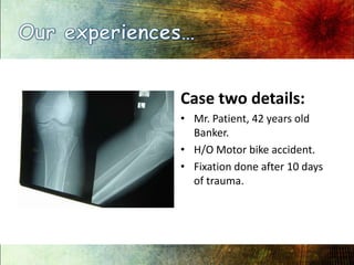 Our experiences…,[object Object],Case two details:,[object Object],Mr. Patient, 42 years old Banker. ,[object Object],H/O Motor bike accident.,[object Object],Fixation done after 10 days of trauma.,[object Object]