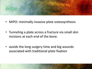 Mipo,[object Object],MIPO: minimally invasive plate osteosynthesis,[object Object],Tunneling a plate across a fracture via small skin incisions at each end of the bone. ,[object Object],avoids the long surgery time and big wounds associated with traditional plate fixation,[object Object]