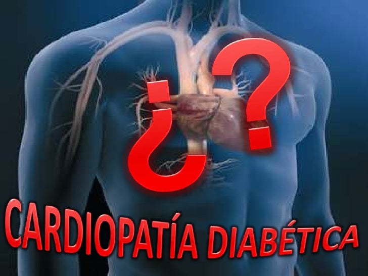CARDIOPATIA DIABETICA EPUB CARDIOPATIA DIABETICA EPUB