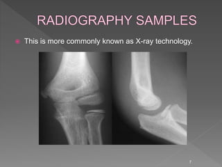  This is more commonly known as X-ray technology.
7
 
