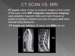  CT scans utilize X-rays to produce images of the inside
of the body while MRI (magnetic resonance imaging)
uses powerful magnetic fields and radio frequency
pulses to produce detailed pictures of organs and other
internal body structures.
 CT scans use radiation (X-rays), and MRIs do not.
9
 